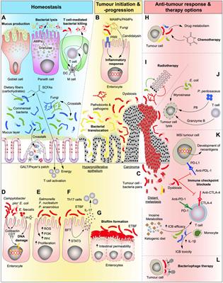 Microbiota and Colorectal Cancer: From Gut to Bedside